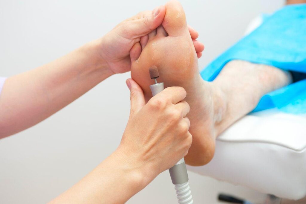 Treating infected blisters on feet – Recognition, home care and medical solutions