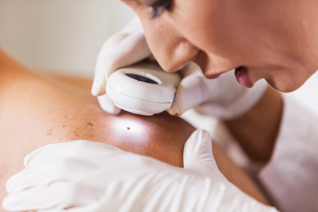 The thing you need to know about Skin Tag Removal