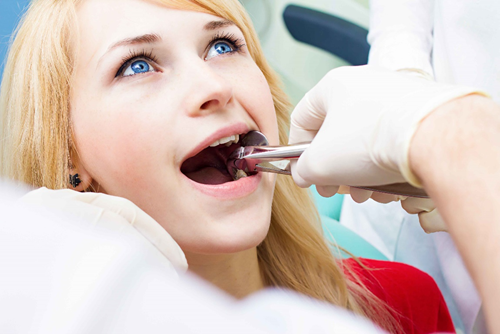The Complex Link Between Wisdom Teeth and Orthodontic Treatment
