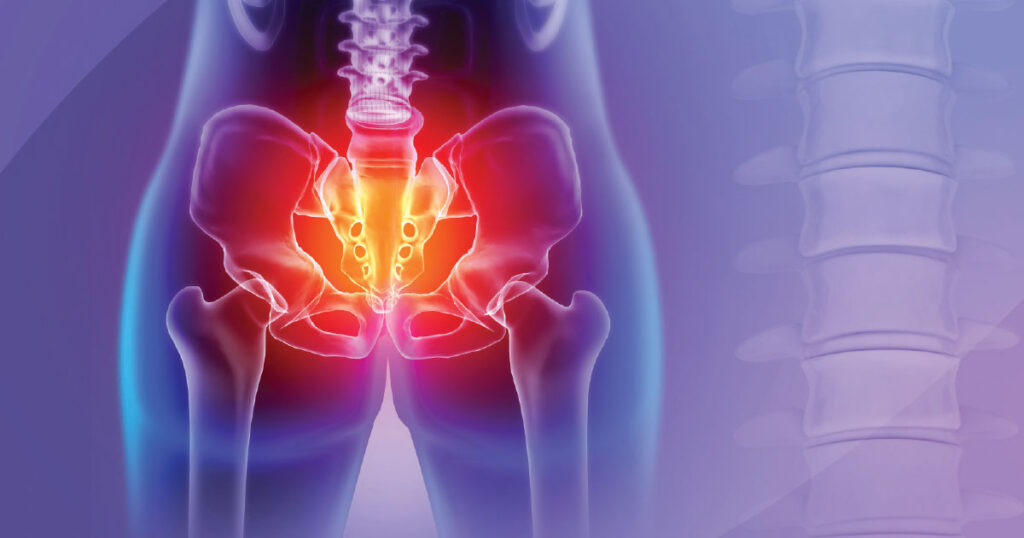 Pain Down There? You Are Not Alone!  Understanding Chronic Pelvic Pain