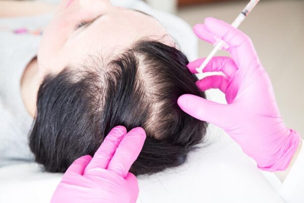 treatment for hair loss