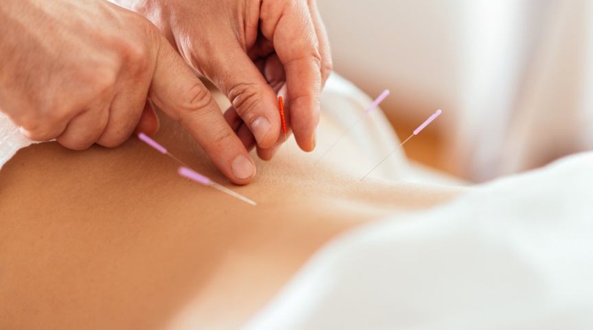 Acupuncture for Fertility